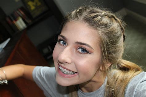 Last vid braces girl : r/bracesgirl5